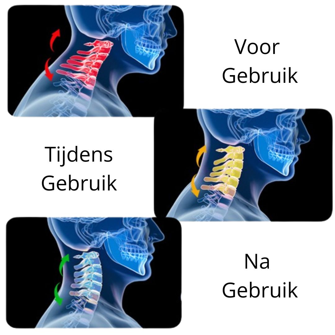 Relaxura™ NeckRelief