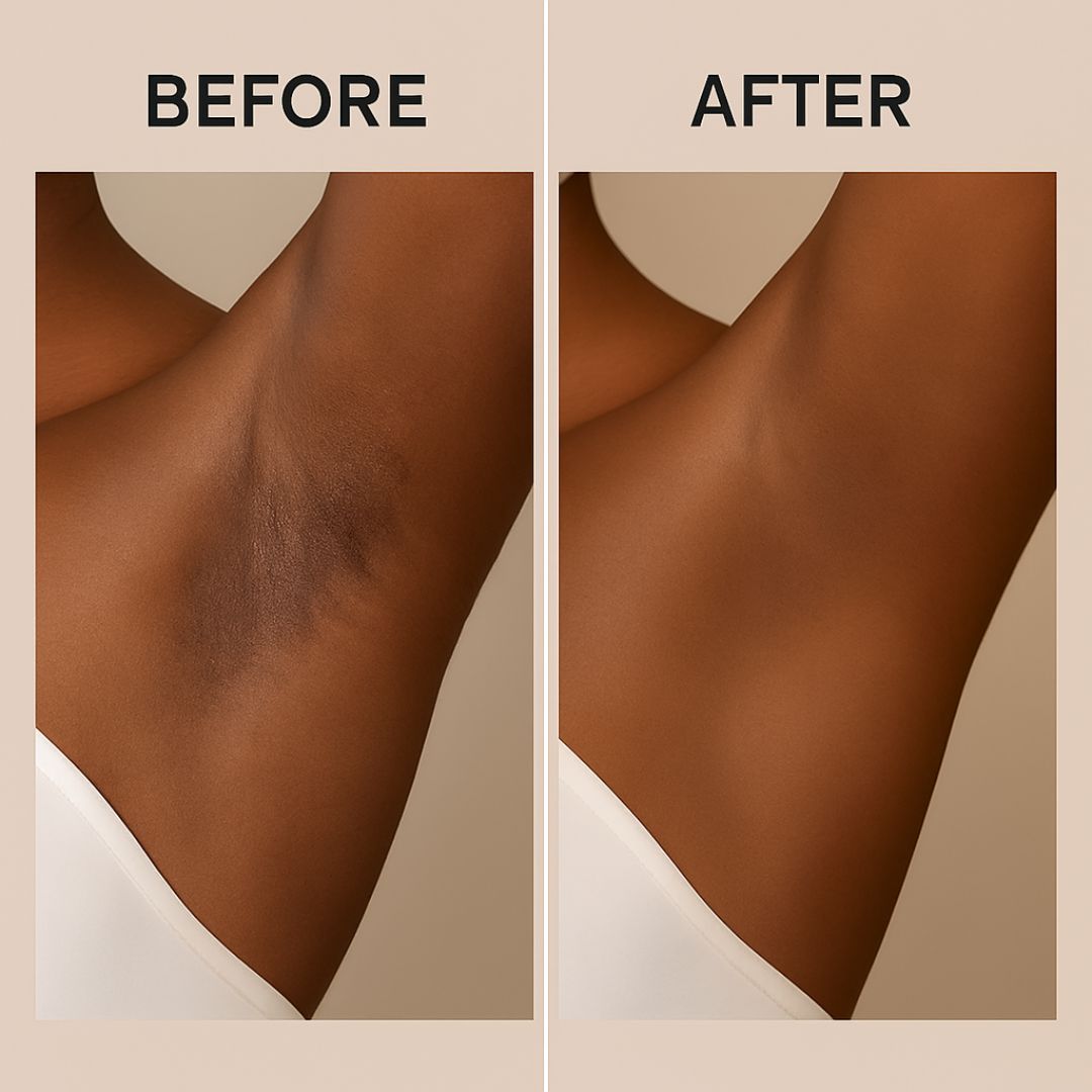 Exabella™ Zuiverende Exfoliërende Gel