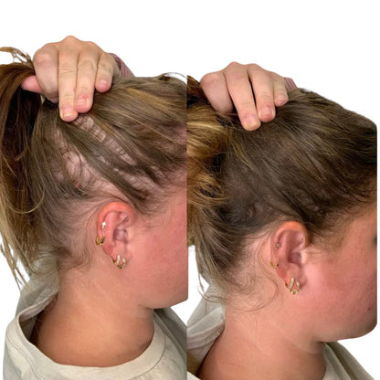 LuminaBrush™ | De 4-in-1 Therapieborstel