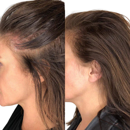 LuminaBrush™ | De 4-in-1 Therapieborstel